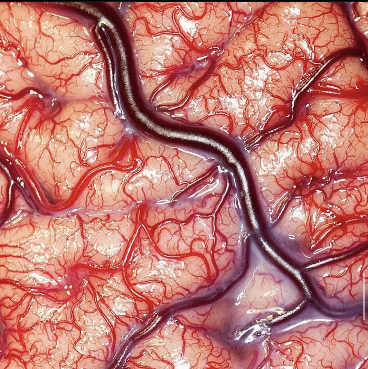 resuscitation training